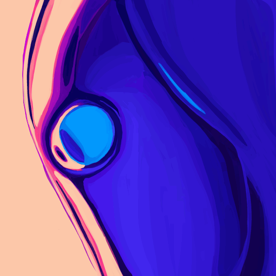 \